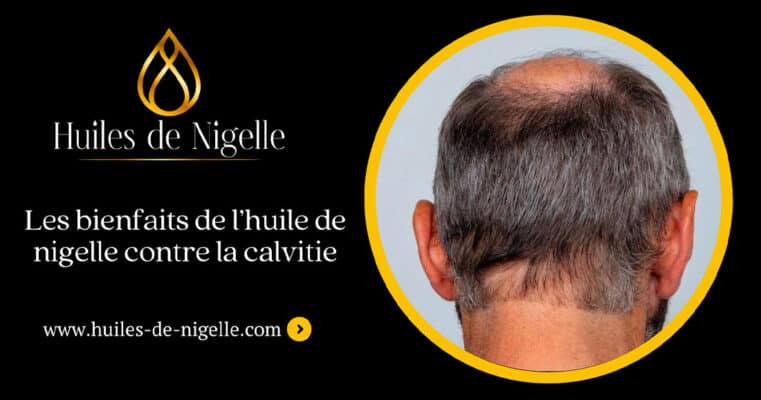 Os benefícios do óleo de cominho preto contra a calvície