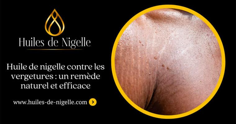Huile de nigelle contre les vergetures